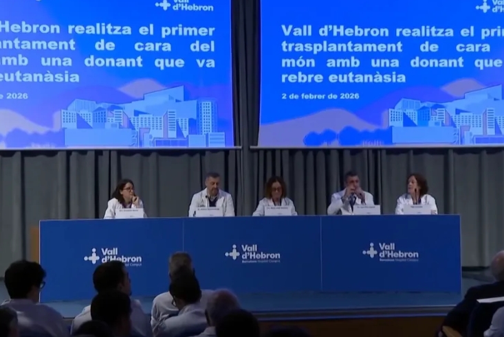 Η ιστορία της Κάρμε: Τι συνέβη στη γυναίκα που δέχτηκε το πρώτο μεταμόσχευμα προσώπου από δότη που είχε υποβληθεί σε ευθανασία